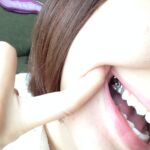 150703Bd-2